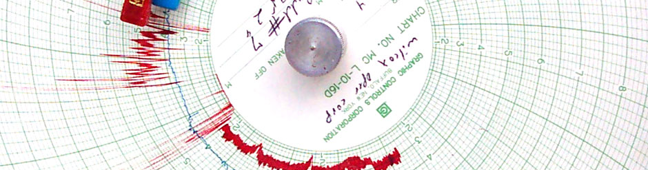 Circular Dial gauge